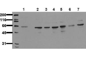 Western Blotting (WB) image for anti-P21-Activated Kinase 4 (PAK4) antibody (ABIN492621) (PAK4 anticorps)