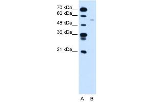 WB Suggested Anti-CCNB1 Antibody Titration:  0.