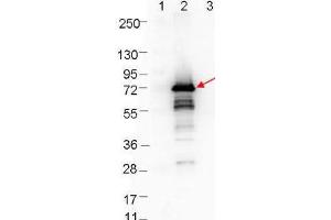 Western blot showing detection of 0. (OspA anticorps)