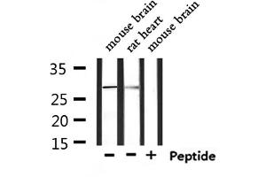 Western blot analysis of extracts from rat heart and mouse brain, using FCGR3A Antibody.