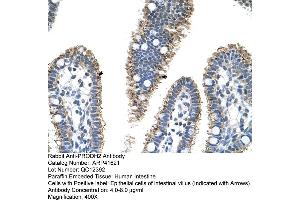 Rabbit Anti-PRODH2 Antibody  Paraffin Embedded Tissue: Human Intestine Cellular Data: Epithelial cells of intestinal villas Antibody Concentration: 4. (PRODH2 anticorps  (C-Term))