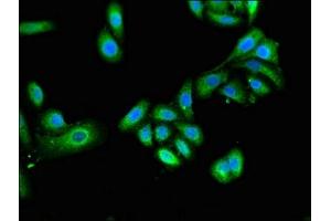 anti-Tripartite Motif-containing 4 (TRIM4) (AA 1-118) antibody