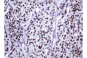 Image no. 9 for anti-Decapping Enzyme, Scavenger (DCPS) antibody (ABIN1497781)