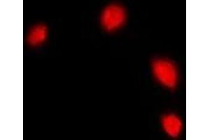Immunofluorescent analysis of IFI16 staining in U2OS cells.