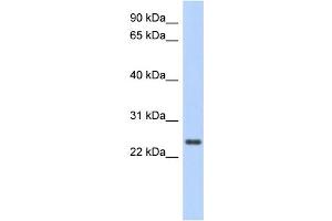 WB Suggested Anti-CCDC70 Antibody Titration: 0. (CCDC70 anticorps  (Middle Region))