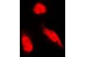 Immunofluorescent analysis of NCK1 staining in Hela cells. (NCK1 anticorps)
