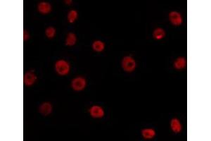 ABIN6266532 staining HepG2 by IF/ICC.