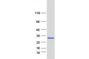 Validation with Western Blot