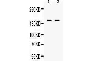 Western blot analysis of CD11a using anti-CD11a antibody . (ITGAL anticorps  (AA 161-349))