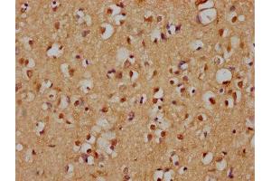 IHC image of ABIN7157954 diluted at 1:200 and staining in paraffin-embedded human brain tissue performed on a Leica BondTM system. (RANBP3L anticorps  (AA 170-295))