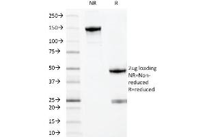 anti-Myeloid-Associated Differentiation Marker (MYADM) antibody