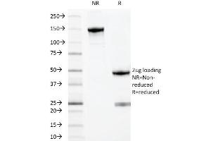 SDS-PAGE Analysis Purified MYADM Mouse Monoclonal Antibody (MYADM/971). (MYADM anticorps)