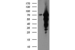 Western Blotting (WB) image for anti-Epsin 2 (EPN2) antibody (ABIN1498052) (Epsin 2 anticorps)