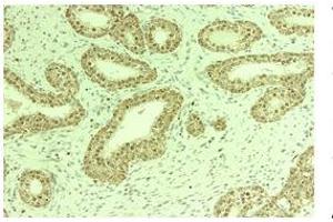 human prostate  Primary Antibodies (from Aviva, Thoc1, Cat No: ARP 40578-P050)(1:150 dilution) (THOC1 anticorps  (C-Term))