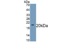 Detection of Recombinant WNT11, Human using Monoclonal Antibody to Wingless Type MMTV Integration Site Family, Member 11 (WNT11)