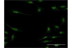 Immunofluorescence of monoclonal antibody to RBM15 on HeLa cell. (RBM15 anticorps  (AA 701-810))