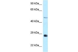 WB Suggested Anti-Agpat9 Antibody Titration: 1.