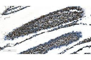 IHC analysis of CDC45L using anti-CDC45L antibody (ABIN7600230). (CDC45 anticorps  (AA 166-431))