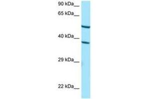 Image no. 1 for anti-Cytochrome P450, Family 4, Subfamily F, Polypeptide 2 (CYP4F2) (AA 288-337) antibody (ABIN6748419)