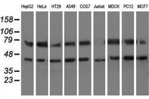 Western blot analysis of extracts (35 µg) from 9 different cell lines by using anti-HSPA6 monoclonal antibody. (HSPA6 anticorps)