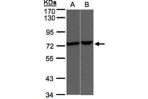 WB Image Sample(30 μg of whole cell lysate) A:A431, B:Raji, 7.