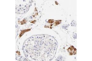 Immunohistochemical staining of human testis with EBP polyclonal antibody  shows strong cytoplasmic positivity in Leydig cells.