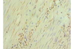 Immunohistochemistry of paraffin-embedded human epityphlon tissue using ABIN7172390 at dilution of 1:100 (GATA3 anticorps  (AA 1-260))