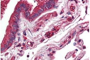 Anti-NR1D2 antibody  ABIN1049134 IHC staining of human lung.