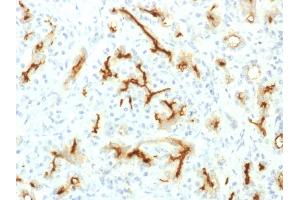 Formalin-fixed, paraffin-embedded human Pancreas stained with CFTR Rabbit Recombinant Monoclonal Antibody (CFTR/1775R). (Recombinant CFTR anticorps  (AA 258-385))