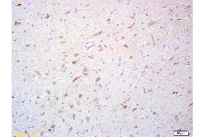 Formalin-fixed and paraffin embedded rat brain labeled with Rabbit Anti- Scavenger receptor class B member 1 Polyclonal Antibody, Unconjugated (ABIN738936) at 1:200 followed by conjugation to the secondary antibody and DAB staining (SCARB1 anticorps  (AA 21-100))