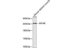Western blot analysis of extracts of Mouse skeletal muscle using MYH6 Polyclonal Antibody.