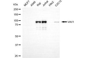 Western blotting analysis using VAV1 antibody (ABIN7800827).