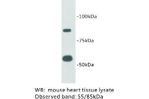 Image no. 1 for anti-Transmembrane Protein 2 (TMEM2) antibody (ABIN1112936)
