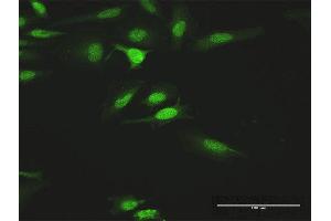Immunofluorescence of purified MaxPab antibody to HCK on HeLa cell. (HCK anticorps  (AA 1-505))
