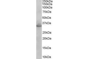 Western Blotting (WB) image for anti-Coiled-Coil Domain Containing 114 (CCDC114) (C-Term) antibody (ABIN2774525) (CCDC114 anticorps  (C-Term))