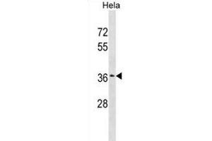 ZSCAN23 Antibody (Center) (ABIN1882043 and ABIN2838990) western blot analysis in Hela cell line lysates (35 μg/lane).
