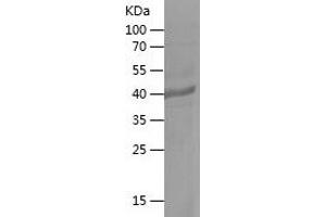 Western Blotting (WB) image for Fucosyltransferase 7 (Alpha (1,3) Fucosyltransferase) (FUT7) (AA 144-342) protein (His-IF2DI Tag) (ABIN7123014)