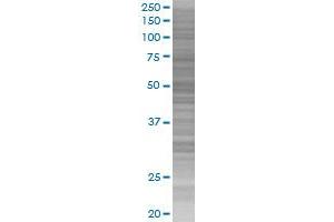 IL13RA2 transfected lysate. (IL13RA2 293T Cell Transient Overexpression Lysate(Denatured))