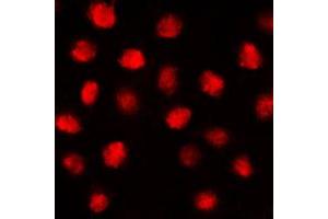Immunofluorescent analysis of EGR1 staining in MCF7 cells. (EGR1 + EGR2 (C-Term) anticorps)