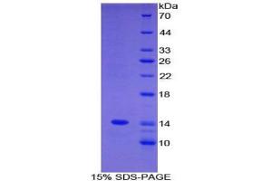 SDS-PAGE analysis of Mouse C4BPa Protein. (C4BPA Protéine)