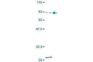 Image no. 1 for Zinc Finger Protein 25 (ZNF25) (AA 1-420) protein (GST tag) (ABIN1326020)
