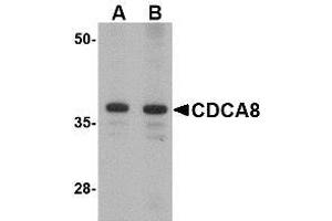 Western blot analysis of CDCA8 in Rat kidney lysate with AP30218PU-N CDCA8 antibody at (A) 1 and (B) 2 μg/ml. (CDCA8 anticorps  (N-Term))