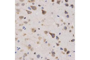Immunohistochemistry of paraffin-embedded rat brain using KPNA4 Antibody (ABIN5971058) at dilution of 1/200 (40x lens). (KPNA4 anticorps)