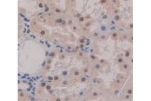 Used in DAB staining on fromalin fixed paraffin- embedded Kidney tissue (PYGO2 anticorps  (AA 171-406))