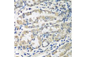 Immunohistochemistry of paraffin-embedded human stomach using CCT6A antibody at dilution of 1:100 (40x lens). (CCT6A anticorps)