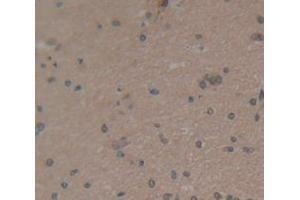 IHC-P analysis of Human Tissue, with DAB staining. (Osteocalcin anticorps  (AA 21-99))