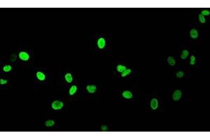 Immunofluorescent analysis of HepG2 cells (sodium butyrate, 30 mM, 4h) using ABIN7139164 at dilution of 1:100 and Alexa Fluor 488-congugated AffiniPure Goat Anti-Rabbit IgG(H+L) (Histone H1.5 anticorps  (acLys16))