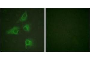Immunofluorescence analysis of HeLa cells, using DRP-2 (Ab-514) Antibody. (DRP2 anticorps  (AA 480-529))