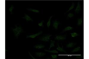 Immunofluorescence of monoclonal antibody to SP3 on HeLa cell. (Sp3 anticorps  (AA 287-430))