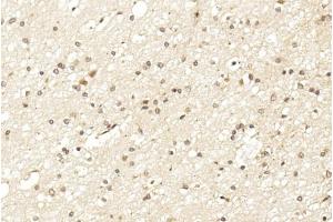 Immunohistochemical analysis of paraffin-embedded Human brain section using LINGO-1(LRRN6A)- (C-term) Antibody (ABIN651289 and ABIN2840172).